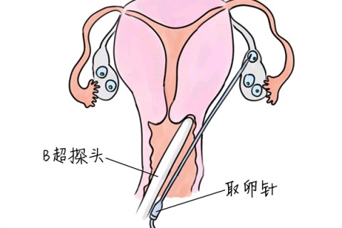 http://zhuhai.huochezhan.net/post/205.html|珠海供卵助孕