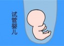 培养珠海捐卵宝宝艺术细胞的小技巧